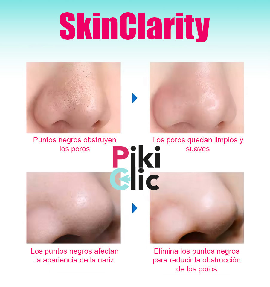 SkinClarity™ Limpiador puntos Negros