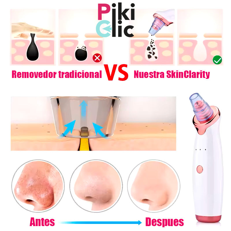 SkinClarity™ Limpiador puntos Negros